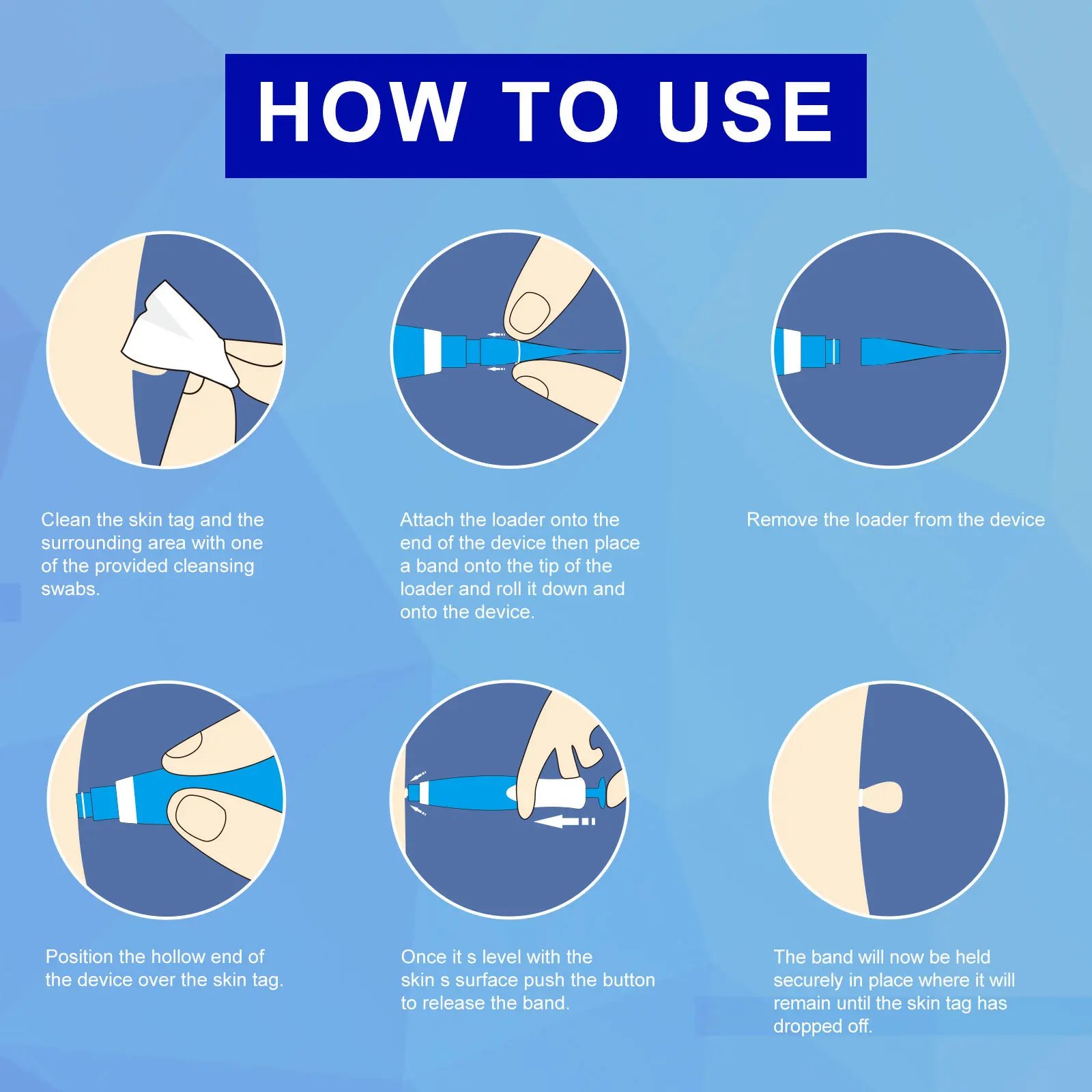 Skin Tag Remover Kit: A Safe and Effective Solution