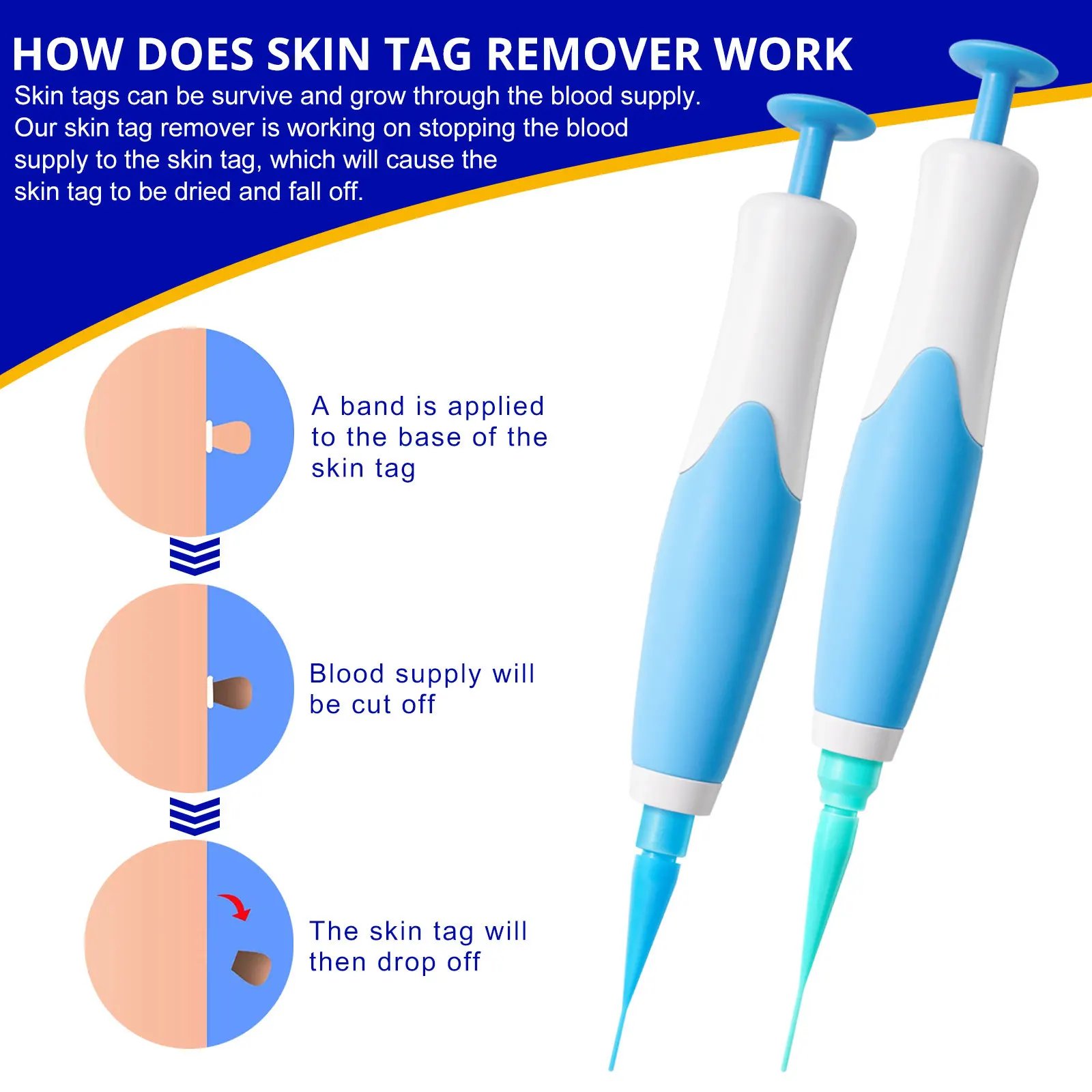 Skin Tag Remover Kit: A Safe and Effective Solution