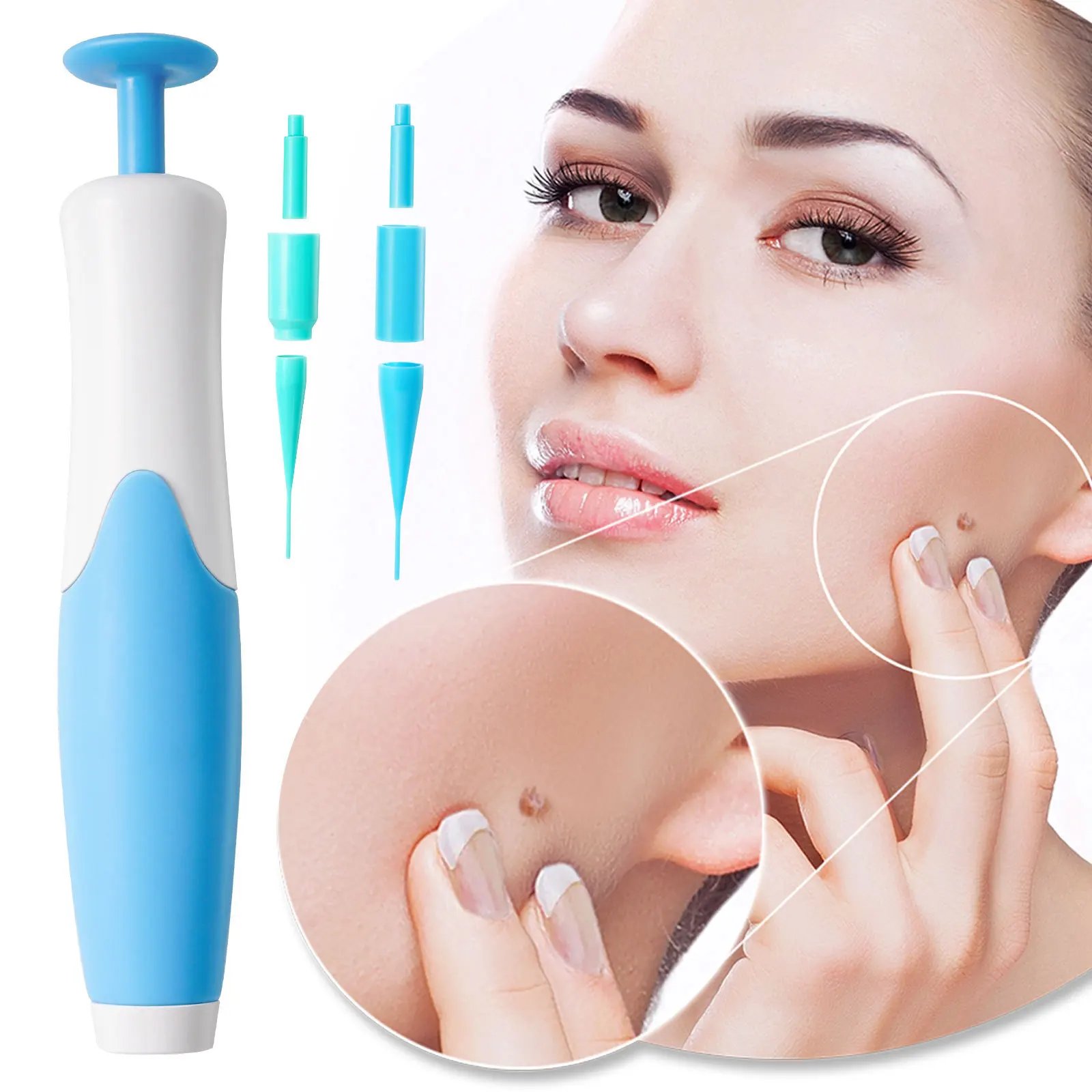 Skin Tag Remover Kit: A Safe and Effective Solution